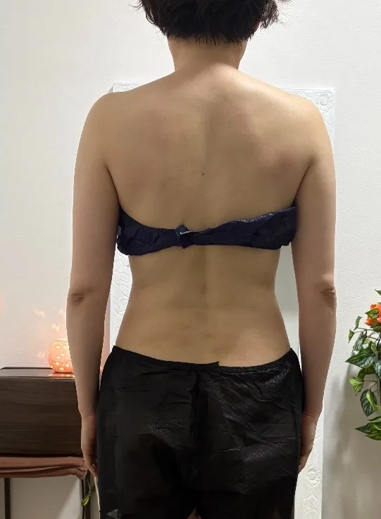 後ろ姿 施術後