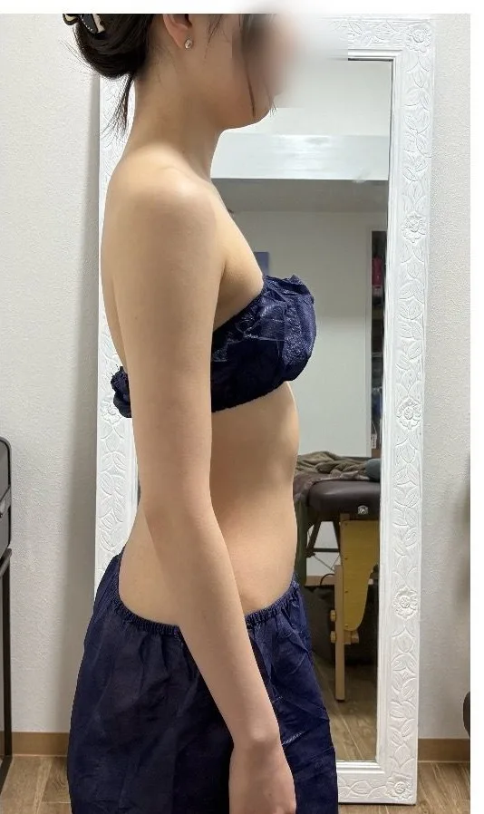 姿勢 横から ビフォーアフター 施術後